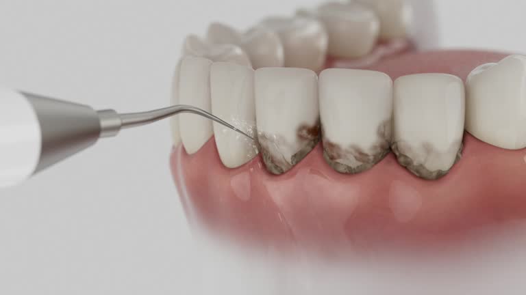 Trusted Wisdom Tooth Removal service in Farmers Loop, AK - Dentist Open Now